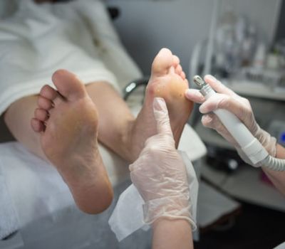 doctor-prepare-to-clean-patient-feet-with-special-2024-11-29-05-00-53-utc (1) (1)