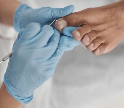 podiatrist-in-blue-gloves-cleans-toenail-of-man-us-2025-03-27-02-00-24-utc (1) (1)